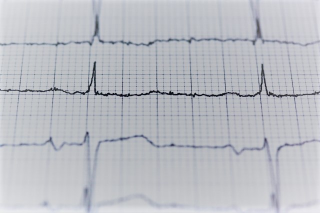 margaux dewitte ARC CRA recherche clinique clinical research freelance france bordeaux